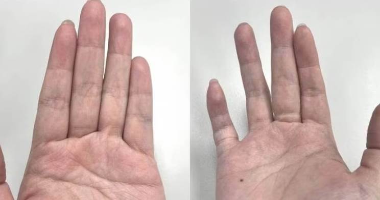 小拇指一彎就知道！晚年是享福還是受苦，答案早已藏在手上