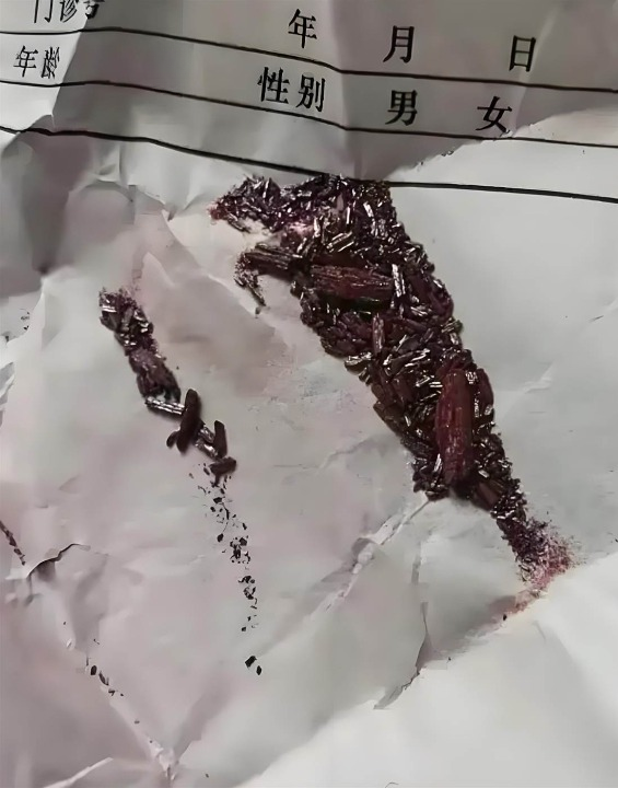 老媽塞「神秘顆粒」進我被窩！我PO圖吐槽，網友秒認出來…我當場破防淚崩