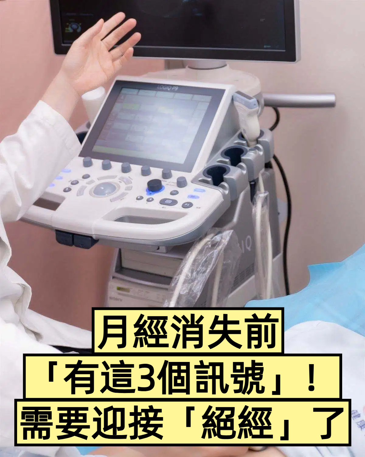 月經消失前「有這3個訊號」!需要迎接「絕經」了