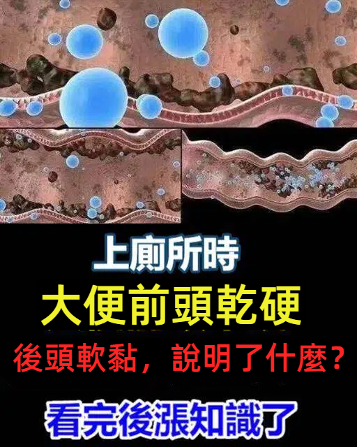 上廁所時,大便前頭乾硬,後頭軟黏,說明了什麼?看完後漲知識了