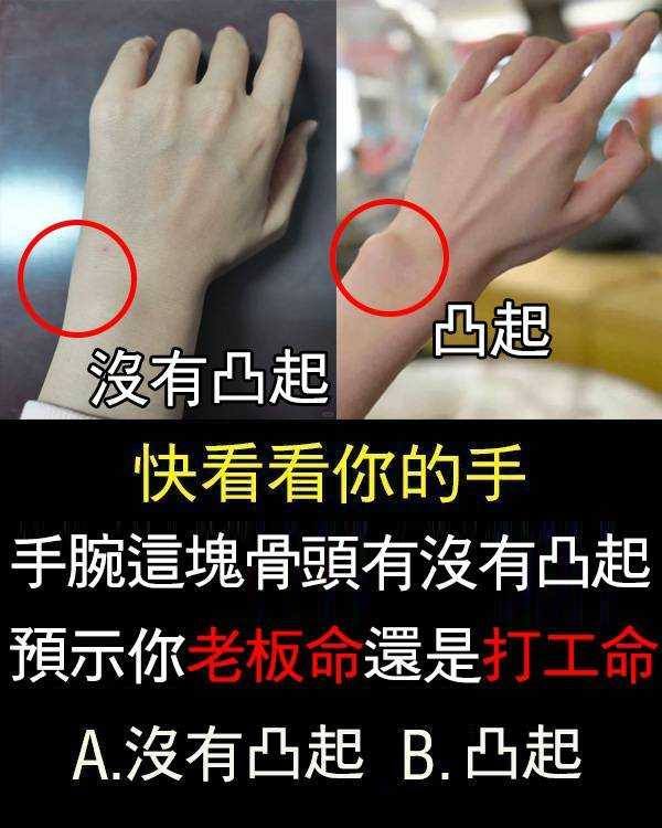 手腕這塊骨頭有沒有凸起，預示你老闆命還是打工命