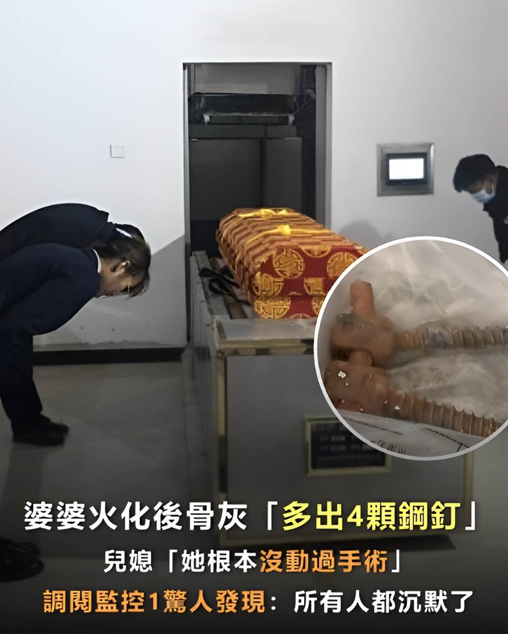 婆婆火化後骨灰「多出4顆鋼釘」,兒媳「她根本沒動過手術」…調閱監控1驚人發現:所有人都沉默了