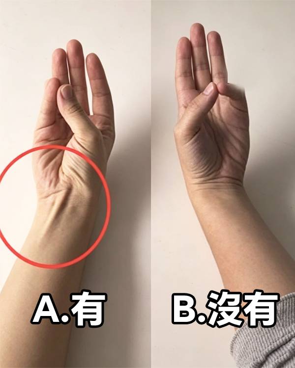 你手腕有「這條筋」嗎？全世界只有「這些人」才有！
