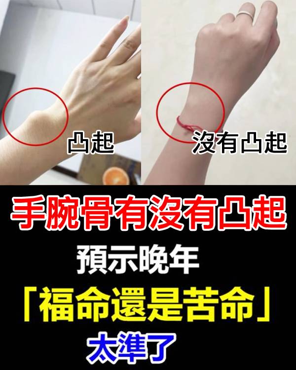 手腕骨有沒有凸起，預示晚年「福命還是苦命」：太準了