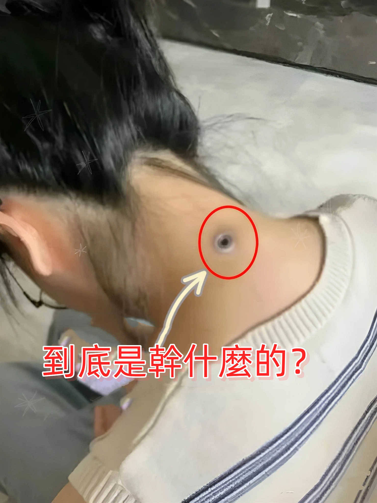 國外回來的表姑，脖子竟多一個「神秘金屬孔」！看完網友猜想：她嚇的不敢說話了