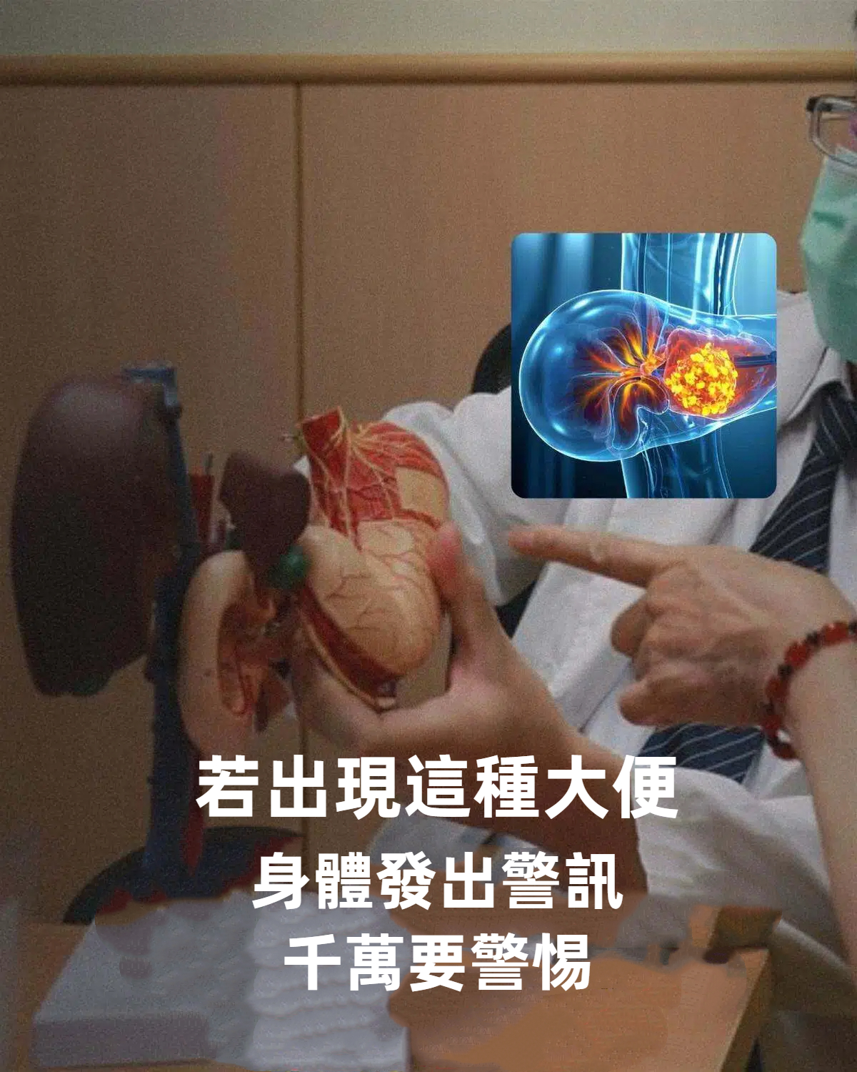 大便若有這5個異常，身體發出警訊，千萬要警惕！