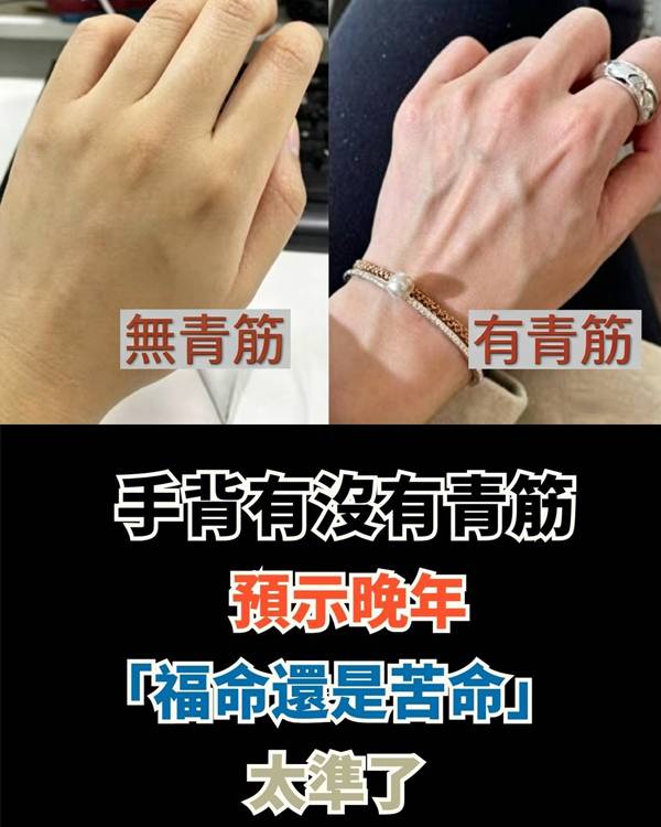 手背有沒有青筋，預示晚年「福命還是苦命」：太準了