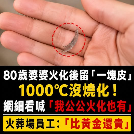 80歲婆婆火化後留「一塊皮」1000℃沒燒化！網細看喊「我公公火化也有」火葬場員工：「比黃金還貴」