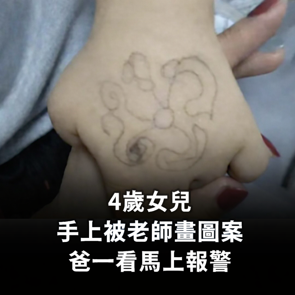 4歲女兒「手上被老師畫圖案」　爸一看「馬上報警」
