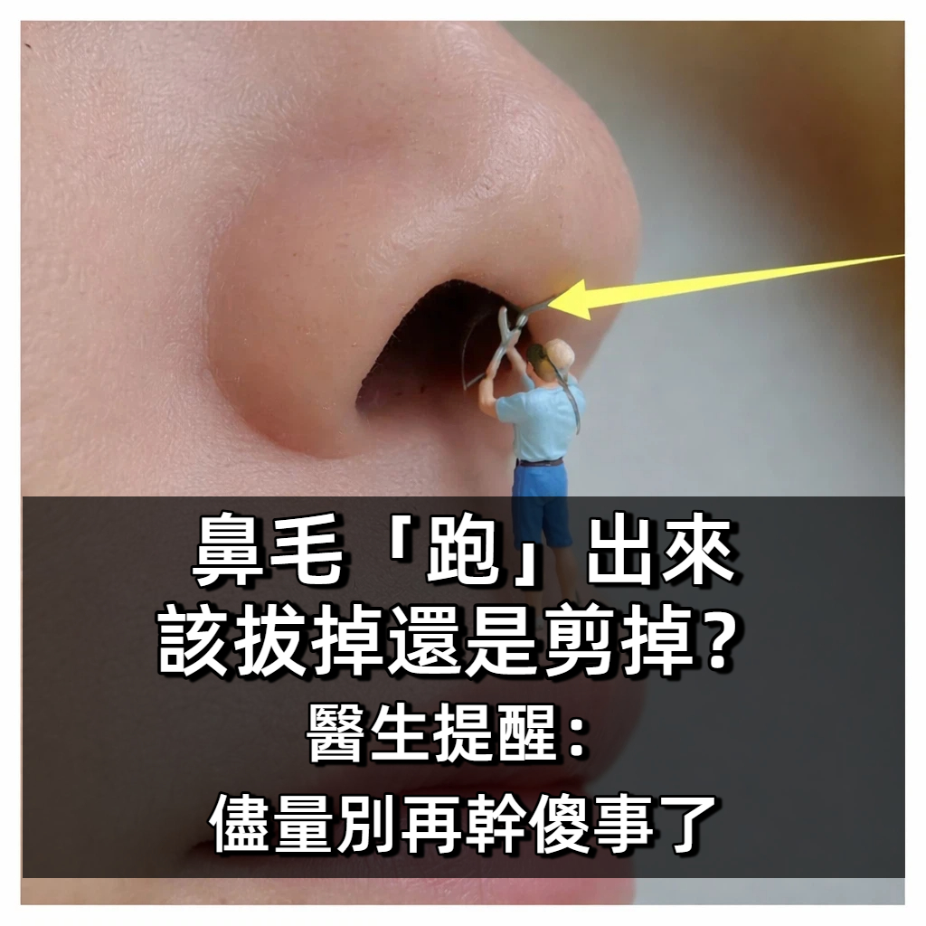 鼻毛「跑」出來，該拔掉還是剪掉？醫生提醒：儘量別再幹傻事了