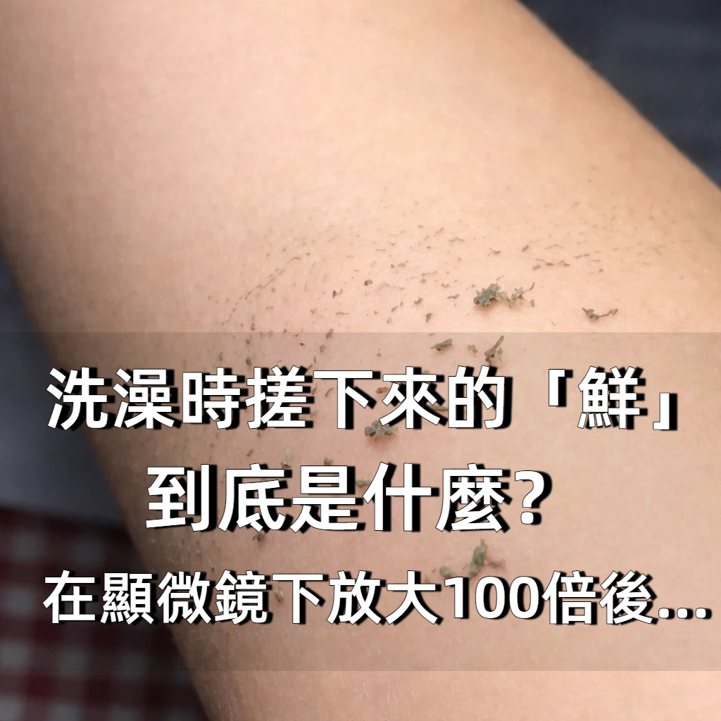 我們洗澡時搓下來的「鮮」到底是什麼?在顯微鏡下放大100倍後…