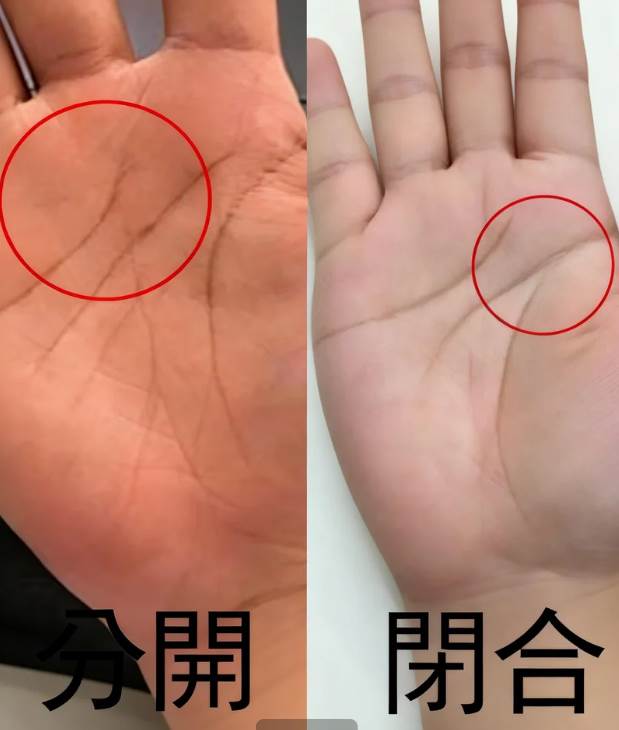 手掌這兩條線「分開」還是「閉合」？預示晚年「福命還是苦命」：太準了！