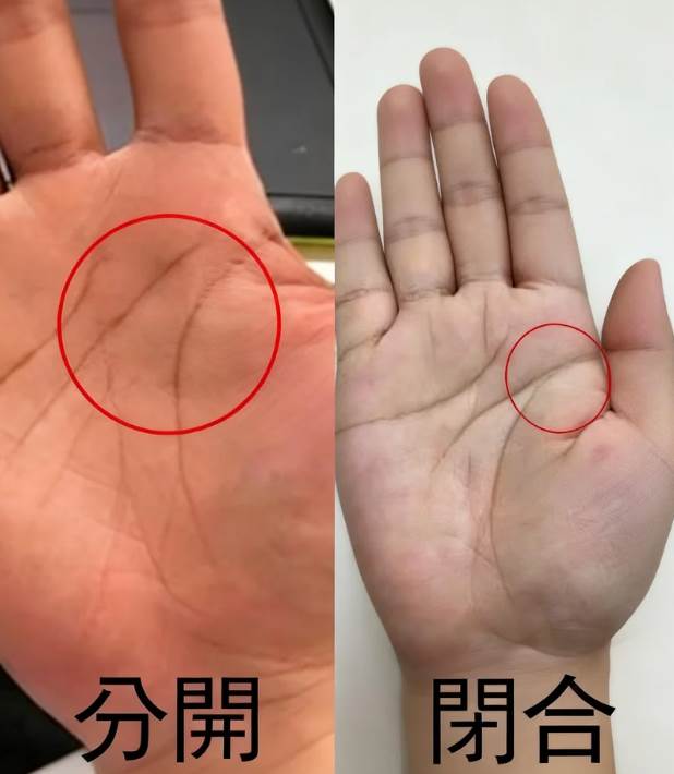 手掌這兩條線「分開」還是「閉合」？預示晚年「福命還是苦命」：太準了！