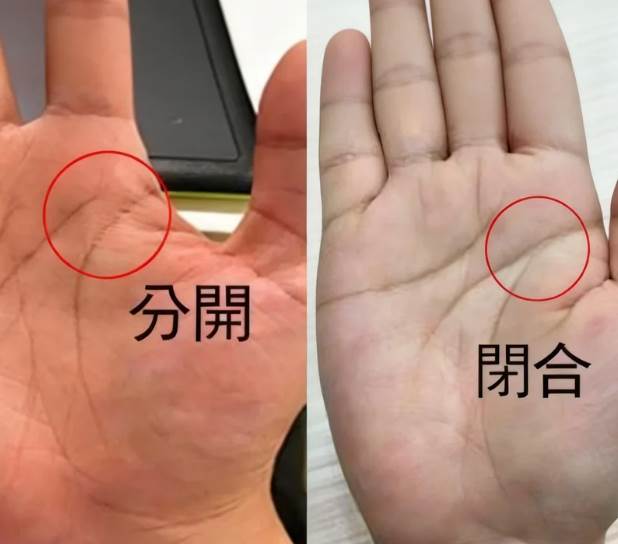手掌這兩條線「分開」還是「閉合」？預示晚年「福命還是苦命」：太準了！