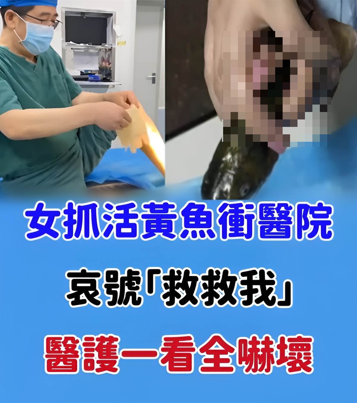 女抓活黃魚衝醫院…哀號「救救我」!醫護一看全嚇壞