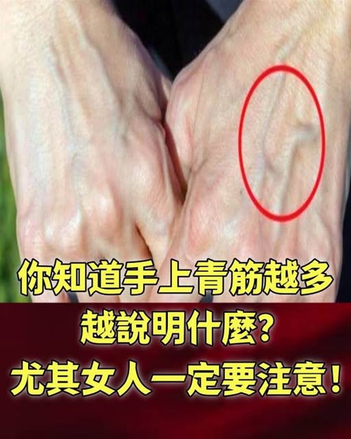 妳知道手上「青筋」越多,說明了什麼嗎?尤其女人一定要注意!